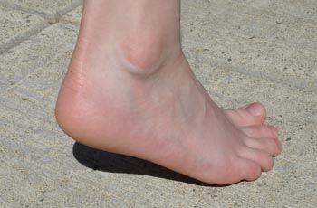 How to prevent and remedy your cracked heels
